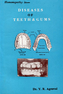 Agrawal Y.R. - Diseases of Teeth & Gums