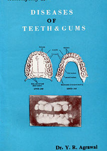Agrawal Y.R. - Diseases of Teeth & Gums
